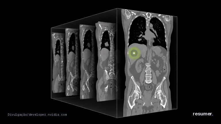 Tomografia computadorizada mostrando detalhes em imagem 3D
